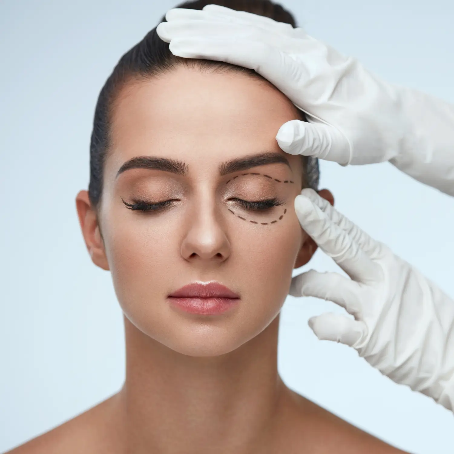 Eyelid Surgery