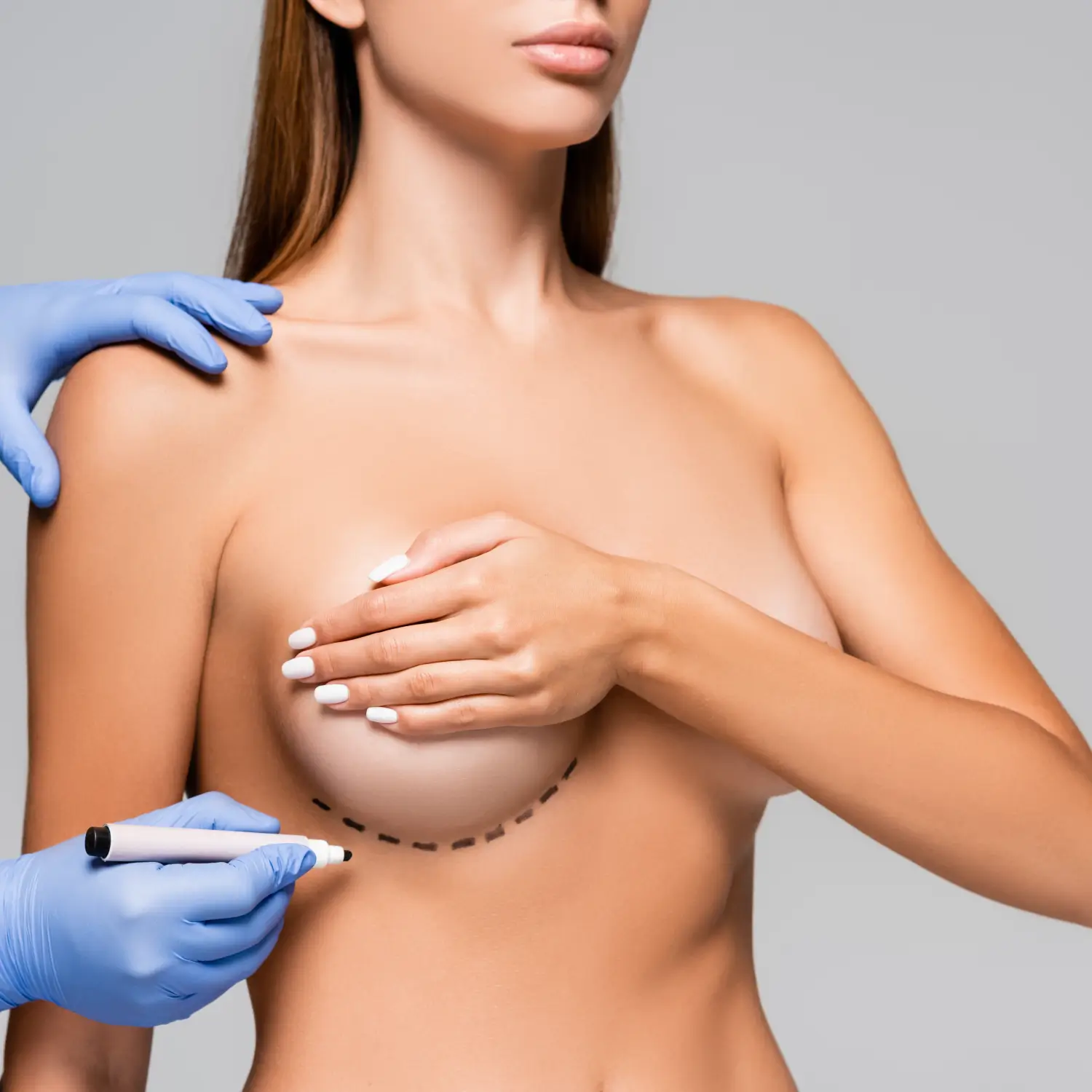 Breast Augmentation